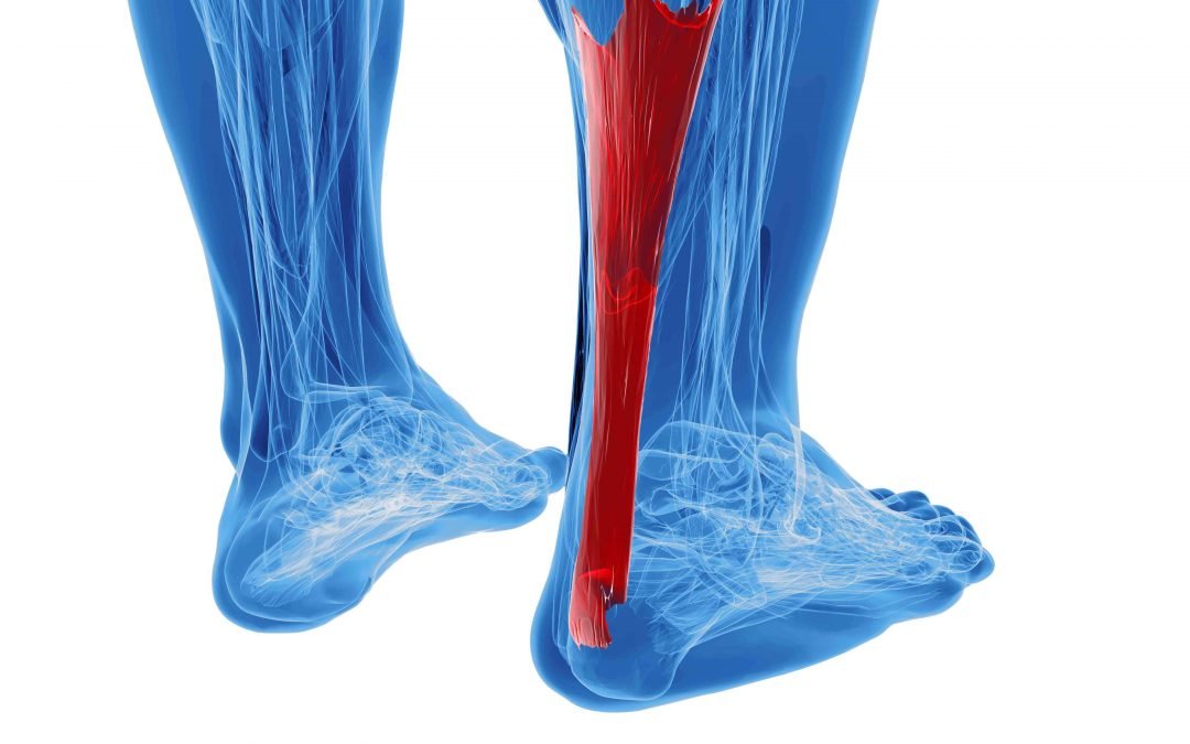 achilles pain after sprained ankle